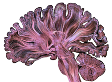 Brain collage